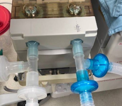 ventilator 770x433 1